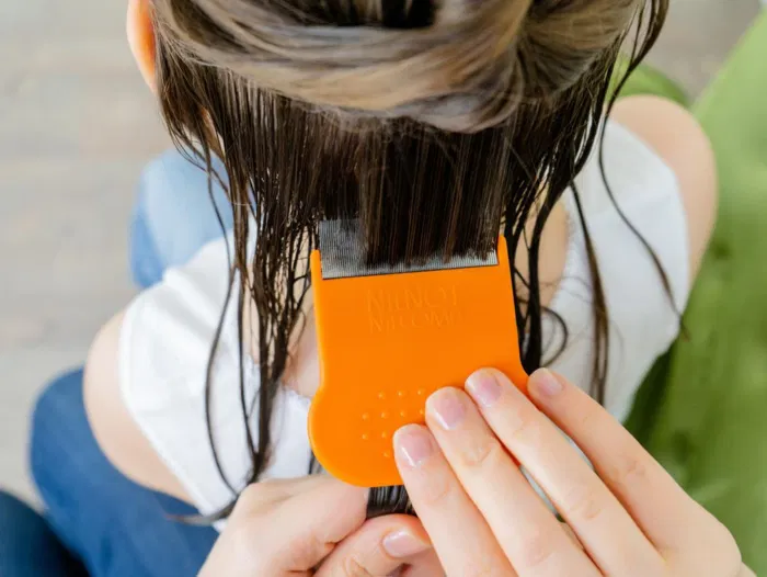 Professional head lice treatment — when to book a clinic