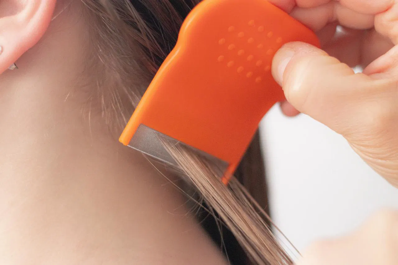 Why head lice treatments keep failing and when to book professional head lice treatment
